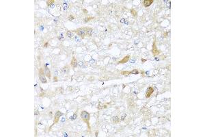 Immunohistochemistry of paraffin-embedded rat brain using CBR4 antibody at dilution of 1:100 (x40 lens). (CBR4 Antikörper)