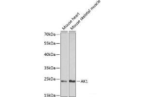 Western blot analysis of extracts of various cell lines using AK1 Polyclonal Antibody at dilution of 1:1000. (Adenylate Kinase 1 Antikörper)