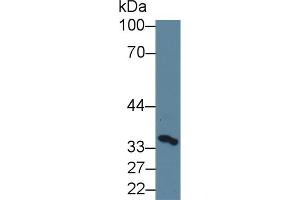 Detection of SCCA1/SCCA2 in Porcine Cerebrum lysate using Polyclonal Antibody to Squamous Cell Carcinoma Antigen 1/2 (SCCA1/SCCA2) (Squamous Cell Carcinoma Antigen 1/2 (AA 211-390) Antikörper)