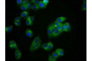 Immunofluorescence staining of HepG2 cells with ABIN7174072 at 1:100, counter-stained with DAPI. (ROR2 Antikörper  (AA 752-926))