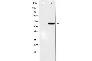Western blot analysis of Epo-R expression in EPO treated COS7 whole cell lysates,The lane on the left is treated with the antigen-specific peptide. (EPOR Antikörper)