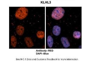 Sample Type : Human brain stem cells Primary Antibody Dilution : 1:500 Secondary Antibody : Goat anti-rabbit Alexa-Fluor 594 Secondary Antibody Dilution : 1:1000 Color/Signal Descriptions : KLHL3: Red DAPI:Blue Gene Name : KLHL3 Submitted by : Dr. (KLHL3 Antikörper  (N-Term))