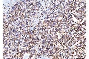 IHC analysis of Poliovirus Receptor/PVR using anti-Poliovirus Receptor/PVR antibody (ABIN7601071). (Poliovirus Receptor Antikörper  (AA 28-331))