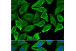 Immunofluorescence analysis of A549 cells using IFNA1 Polyclonal Antibody (IFNA1 Antikörper)