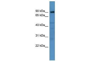 Western Blot showing Adam22 antibody used at a concentration of 1-2 ug/ml to detect its target protein.