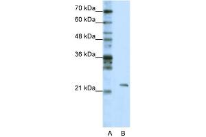 WB Suggested Anti-MRM1 Antibody Titration:  1. (MRM1 Antikörper  (C-Term))