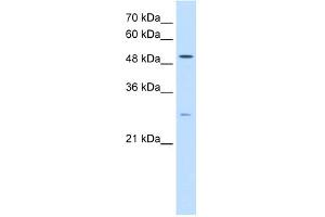 WB Suggested Anti-RRP1 Antibody Titration:  0.
