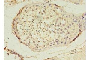 Immunohistochemistry of paraffin-embedded human testis tissue using ABIN7159638 at dilution of 1:100 (TET3 Antikörper  (AA 72-335))