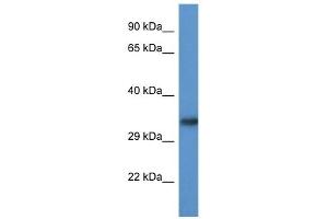 Western Blot showing ACBD6 antibody used at a concentration of 1. (ACBD6 Antikörper  (Middle Region))