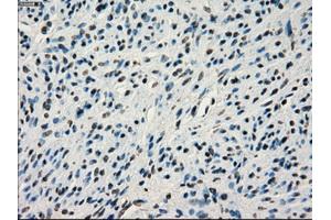 Immunohistochemical staining of paraffin-embedded colon tissue using anti-IRF3mouse monoclonal antibody. (IRF3 Antikörper)