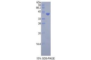 SDS-PAGE (SDS) image for Follicle Stimulating Hormone, beta Polypeptide (FSHB) (AA 21-129) protein (His tag,GST tag) (ABIN1877538) (FSHB Protein (AA 21-129) (His tag,GST tag))