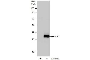 IP Image Immunoprecipitation of DCK protein from 293T whole cell extracts using 5 μg of DCK antibody, Western blot analysis was performed using DCK antibody, EasyBlot anti-Rabbit IgG  was used as a secondary reagent.