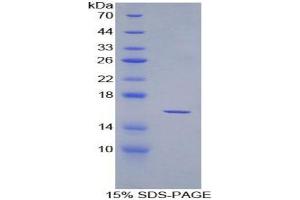 SDS-PAGE analysis of Rat Osteoglycin Protein.