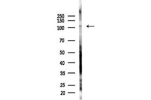 anti-Rap Guanine Nucleotide Exchange Factor (GEF) 4 (RAPGEF4) (C-Term) antibody