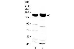 Western blot testing of 1) rat liver and 2) mouse liver with Xanthine Oxidase antibody at 0. (XDH Antikörper)