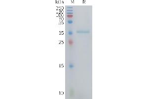 SDS-PAGE (SDS) image for Chemokine (C-C Motif) Ligand 3 (CCL3) (AA 27-92) protein (Fc Tag) (ABIN7538181)