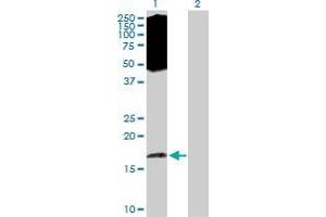 Lane 1: EIF5A2 transfected lysate ( 16.