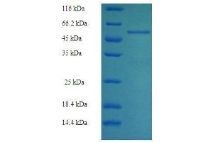 SDS-PAGE of protein expressed in E. (ALDOB Protein (AA 2-364) (His tag))