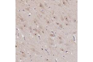 Immunohistochemical staining of human hippocampus with MGA polyclonal antibody  shows nucleolar positivity in neuronal cells at 1:500-1:1000 dilution. (MGA Antikörper)