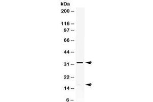 Western blot testing of HeLa cell lysate with IL-8 antibody.