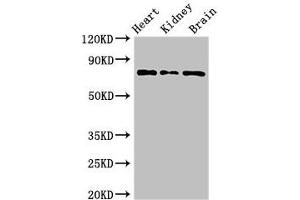 Western Blot Positive WB detected in: Mouse heart tissue, Mouse kidney tissue, Mouse brain tissue All lanes: OVGP1 antibody at 3 μg/mL Secondary Goat polyclonal to rabbit IgG at 1/50000 dilution Predicted band size: 76 kDa Observed band size: 76 kDa (OVGP1 Antikörper  (AA 484-678))