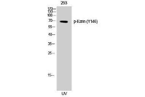 Western Blotting (WB) image for anti-Ezrin (EZR) (pTyr146) antibody (ABIN3182305) (Ezrin Antikörper  (pTyr146))