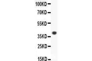 Anti-ALOX15 Picoband antibody,  All lanes: Anti-ALOX15 at 0. (ALOX15 Antikörper  (AA 2-337))