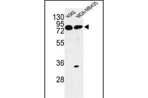 Western blot analysis of PRK Antibody (ABIN652306 and ABIN2841396) in K562, MDA-M cell line lysates (35 μg/lane). (PRKAA1 Antikörper)