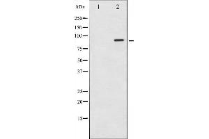 Western blot analysis of STAT6 expression in HeLa whole cell lysates,The lane on the left is treated with the antigen-specific peptide. (STAT6 Antikörper  (Internal Region))