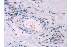 Immunohistochemistry (IHC) image for anti-Endoglin (ENG) (AA 26-136) antibody (ABIN7438025)
