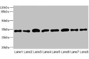 Western blot All lanes: TMBIM1 antibody at 8 μg/mL Lane 1: U251 whole cell lysate Lane 2: K562 whole cell lysate Lane 3: A549 whole cell lysate Lane 4: MCF-7 whole cell lysate Lane 5: Mouse lung tissue Lane 6: Mouse liver tissue Lane 7: Mouse kidney tissue Lane 8: Human placenta tissue Secondary Goat polyclonal to rabbit IgG at 1/10000 dilution Predicted band size: 35 kDa Observed band size: 35 kDa