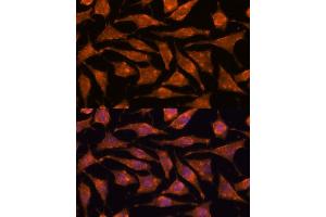 Immunofluorescence analysis of L929 cells using  antibody (ABIN7265356) at dilution of 1:100. (ABHD4 Antikörper  (AA 223-342))