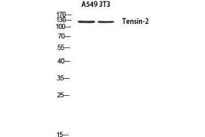 Western Blot (WB) analysis of A549 3T3 using Tensin-2 antibody. (TENC1 Antikörper)