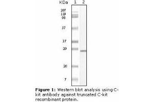 Image no. 1 for anti-Mast/stem Cell Growth Factor Receptor (KIT) antibody (ABIN232128) (KIT Antikörper)