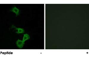 Immunofluorescence analysis of MCF-7 cells, using DAB1 polyclonal antibody . (DAB1 Antikörper)