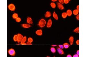 Immunofluorescence analysis of Hela cells using GSTK1 Polyclonal Antibody at dilution of 1:100 (40x lens).