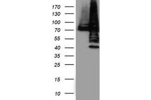 Western Blotting (WB) image for anti-Protein Disulfide Isomerase Family A, Member 4 (PDIA4) antibody (ABIN1500108) (PDIA4 Antikörper)