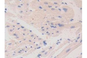 Immunohistochemistry (IHC) image for anti-Laminin, alpha 4 (LAMa4) (AA 745-940) antibody (ABIN7438163)