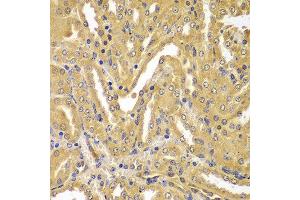 Immunohistochemistry of paraffin-embedded mouse kidney using UBE2Z antibody at dilution of 1:100 (40x lens). (UBE2Z Antikörper)
