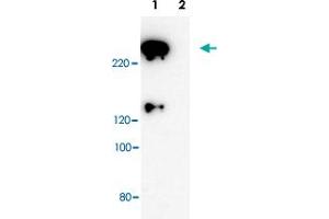 Western blot analysis of Scrib polyclonal antibody . (SCRIB Antikörper)