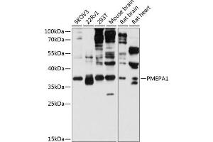Western blot analysis of extracts of various cell lines, using PMEP antibody (2171) at 1:3000 dilution. (PMEPA1 Antikörper  (AA 173-252))