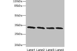 Western blot All lanes: PNP antibody at 16 μg/mL Lane 1: Jurkat whole cell lysate Lane 2: K562 whole cell lysate Lane 3: U937 whole cell lysate Lane 4: 293T whole cell lysate Secondary Goat polyclonal to rabbit IgG at 1/10000 dilution Predicted band size: 33 kDa Observed band size: 33 kDa (PNP Antikörper  (AA 1-289))