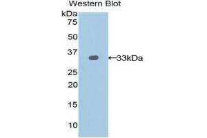 Western Blotting (WB) image for anti-Nexilin (NEXN) (AA 214-455) antibody (ABIN1859993)