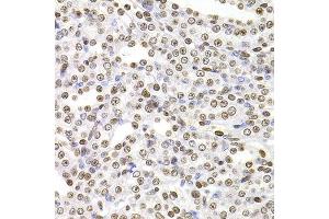 Immunohistochemistry of paraffin-embedded rat kidney using SOX5 antibody at dilution of 1:100 (x400 lens). (SOX5 Antikörper)