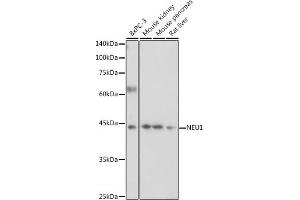 Western blot analysis of extracts of various cell lines, using NEU1 antibody (ABIN6129462, ABIN6144538, ABIN6144539 and ABIN6221903) at 1:1000 dilution. (NEU1 Antikörper  (AA 156-415))
