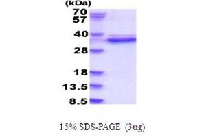 SDS-PAGE (SDS) image for Cyclin-Dependent Kinase 2 (CDK2) (AA 1-298) protein (His tag) (ABIN7280826) (CDK2 Protein (AA 1-298) (His tag))