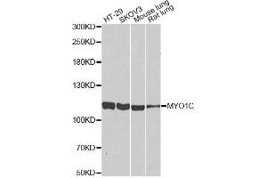 Western blot analysis of extracts of various cell lines, using MYO1C antibody (ABIN2564004) at 1:1000 dilution. (Myosin IC Antikörper)