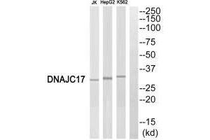 Western blot analysis of extracts from Jurkat cells, HepG2 cells and K562 cells, using DNAJC17 antibody. (DNAJC17 Antikörper  (N-Term))
