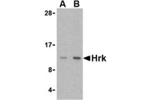 Image no. 1 for anti-Harakiri, BCL2 Interacting Protein (Contains Only BH3 Domain) (HRK) (Middle Region) antibody (ABIN318750)