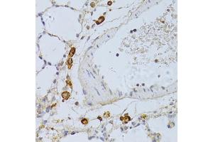 Immunohistochemistry of paraffin-embedded rat lung using PHGDH antibody (ABIN4904748) at dilution of 1:100 (40x lens). (PHGDH Antikörper)